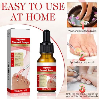 2-Pack Ingrown Toenail Drops & Relief Kit with Silicone Gel Toe Caps | AUJ Avelisse
