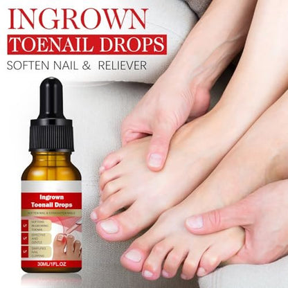 2-Pack Ingrown Toenail Drops & Relief Kit with Silicone Gel Toe Caps | AUJ Avelisse