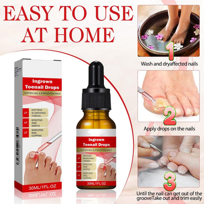 2-Pack Ingrown Toenail Drops & Relief Kit with Silicone Gel Toe Caps | AUJ Avelisse