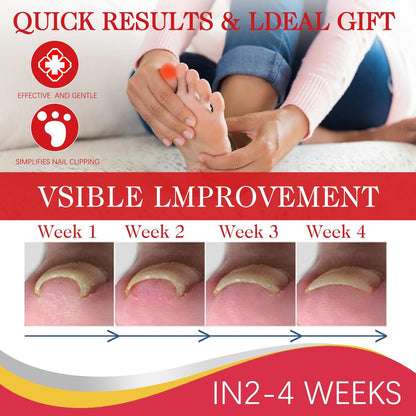 2-Pack Ingrown Toenail Drops & Relief Kit with Silicone Gel Toe Caps | AUJ Avelisse