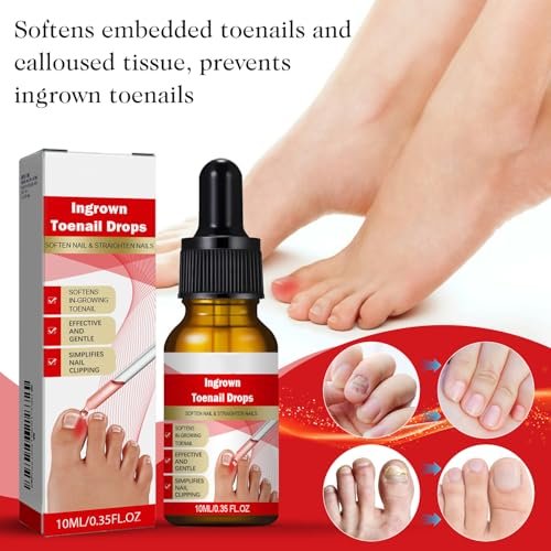 2-Pack Ingrown Toenail Drops & Relief Kit with Silicone Gel Toe Caps | AUJ Avelisse