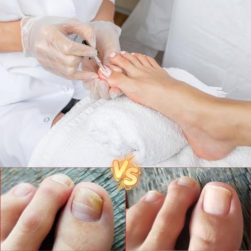 2-Pack Ingrown Toenail Drops & Relief Kit with Silicone Gel Toe Caps | AUJ Avelisse