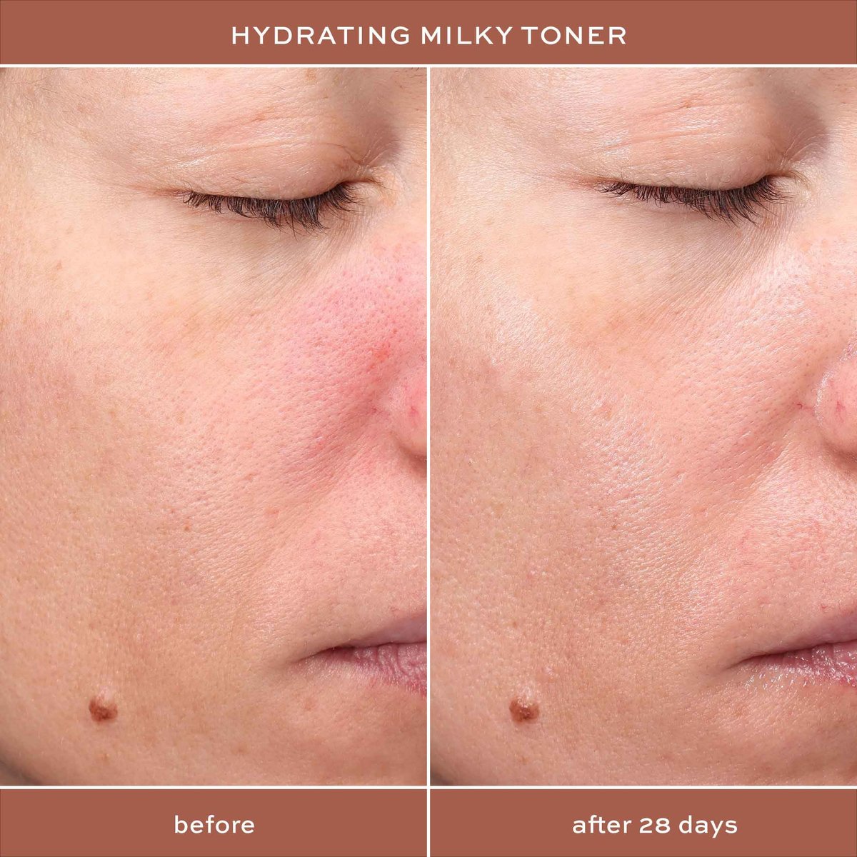 ITK Hydrating Hyaluronic Acid Milky Face Toner for Dry Skin + Redness with Green Tea + Squalane - Prep, Tone + Calm Skin - Soothing Vegan Moisturizing Facial Toner - 5 oz Avelisse