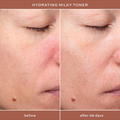 ITK Hydrating Hyaluronic Acid Milky Face Toner for Dry Skin + Redness with Green Tea + Squalane - Prep, Tone + Calm Skin - Soothing Vegan Moisturizing Facial Toner - 5 oz Avelisse