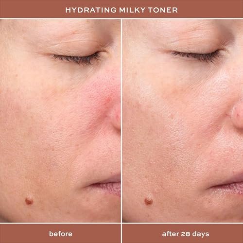 ITK Hydrating Hyaluronic Acid Milky Face Toner for Dry Skin + Redness with Green Tea + Squalane - Prep, Tone + Calm Skin - Soothing Vegan Moisturizing Facial Toner - 5 oz Avelisse