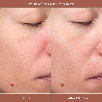 ITK Hydrating Hyaluronic Acid Milky Face Toner for Dry Skin + Redness with Green Tea + Squalane - Prep, Tone + Calm Skin - Soothing Vegan Moisturizing Facial Toner - 5 oz Avelisse