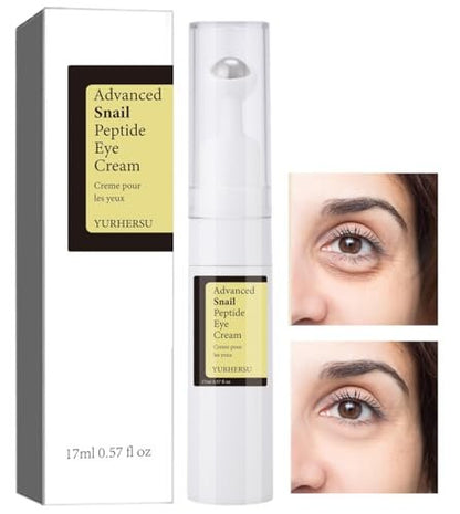 ELCHHIRSCH Snail Peptide Under Eye Cream – 2% Nicotinamide (Vitamin B3): Brightens dark circles, evens skin tone, – Image 2