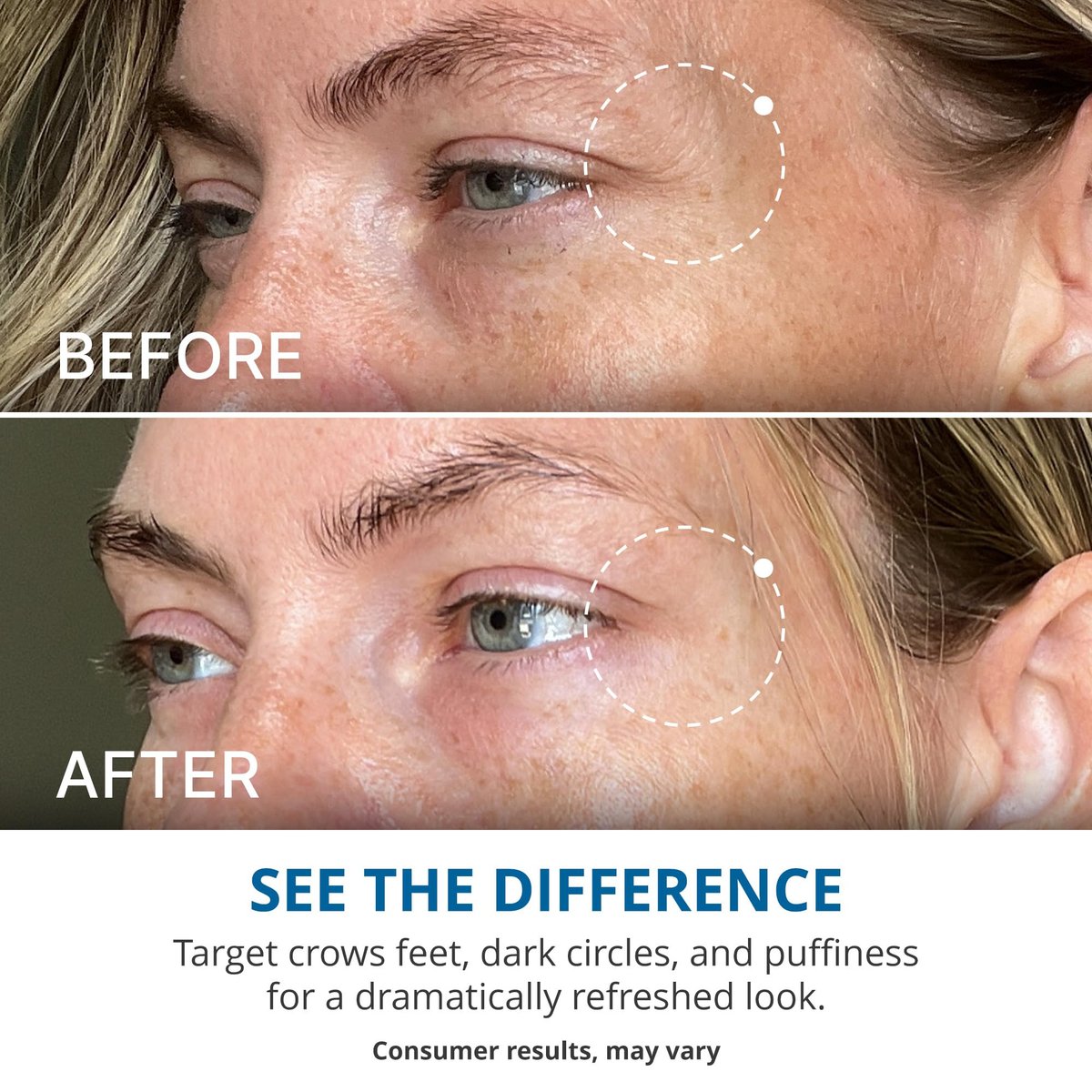 goPure Advanced Repair Eye Cream – Reduce Puffiness, Dark Circles & Fine Lines Avelisse