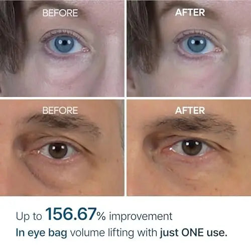 Dr.Melaxin Eyephalt Eyebag Cream 10ml – Targeted Eye Bag Treatment Avelisse