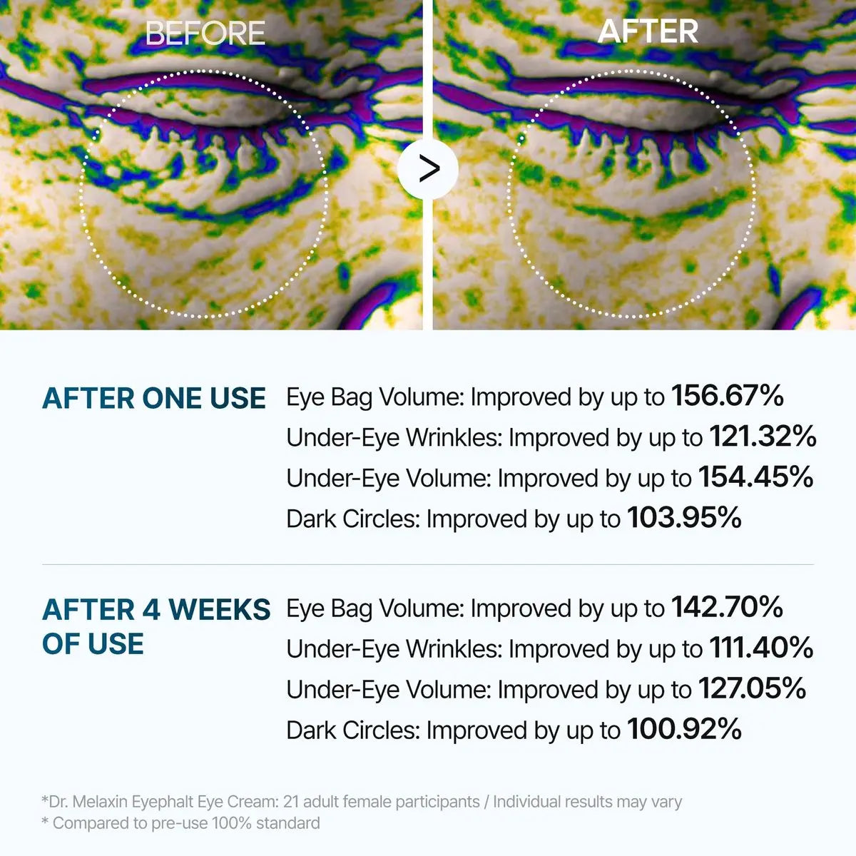 Dr.Melaxin Eyephalt Eyebag Cream 10ml – Targeted Eye Bag Treatment Avelisse