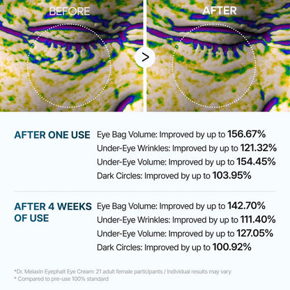 Dr.Melaxin Eyephalt Eyebag Cream 10ml – Targeted Eye Bag Treatment Avelisse