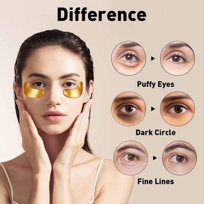 CHMI 24K Gold Under Eye Patches - 100 Pairs for Puffy Eyes, Dark Circles, Eye Bags & Wrinkles - Collagen Infused Hydrogel Eye Mask