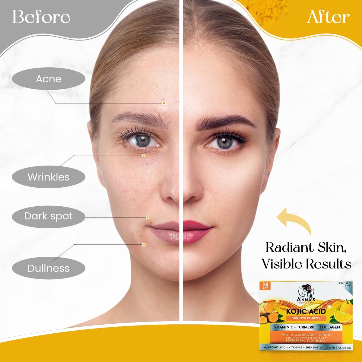 Anna's Skincare Kojic Acid Turmeric Soap Bar - 2-Pack for Radiant Complexion & Natural Glow - görsel 13