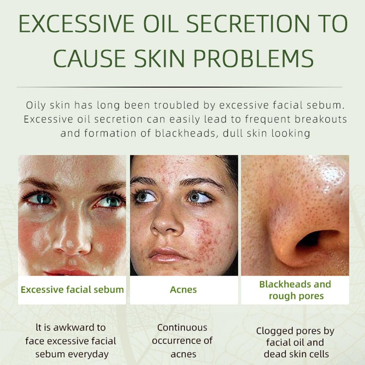 Acne Removing Face Cream - Natural Ingredients for Teens & Adults - Anti-Acne Moisturizer Pimple Cream by Grospe - görsel 3