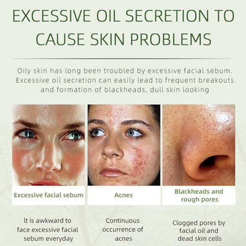 Acne Removing Face Cream - Natural Ingredients for Teens & Adults - Anti-Acne Moisturizer Pimple Cream by Grospe - görsel 4