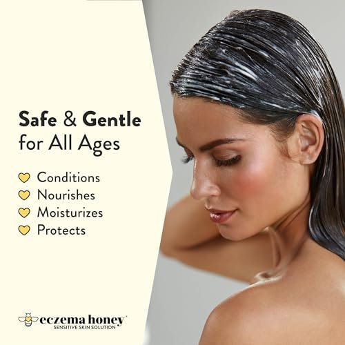 ECZEMA HONEY Nourishing Conditioner - Soothing Relief for Psoriasis, Dermatitis, Dandruff & Itchy Scalp - Daily Scalp Care for Men, Women & Kids (8 Oz) Avelisse