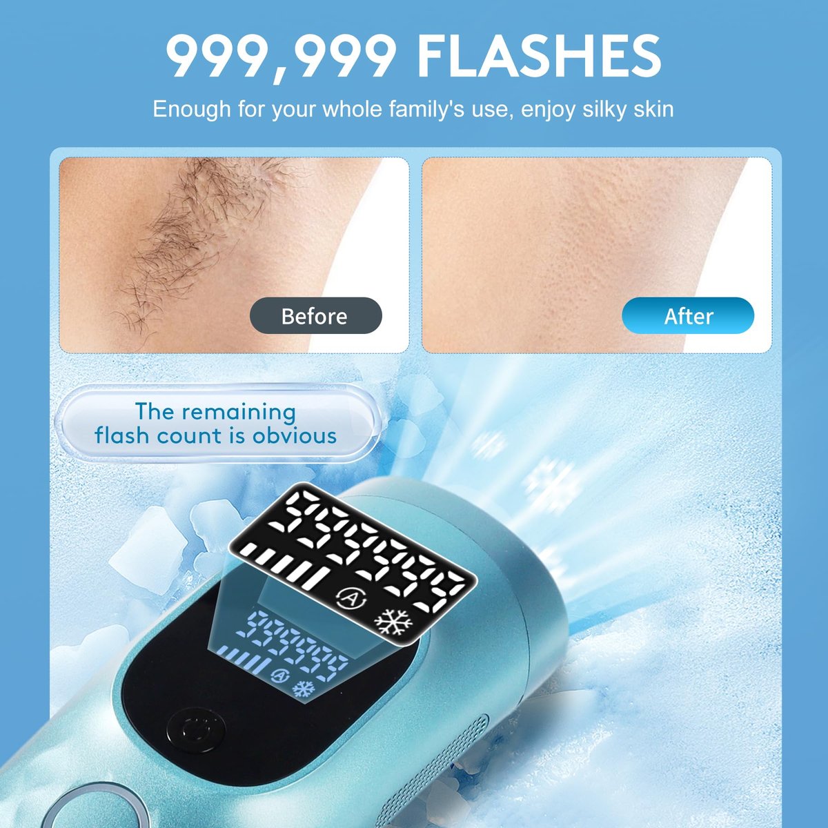 Permanent Painless Ice Cooling IPL Laser Hair Removal for Women and Men - 999,999 Flashes, Corded Device with Shaver and Goggles for Body and Face Avelisse