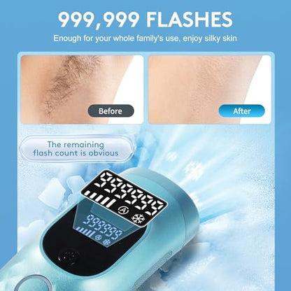 Permanent Painless Ice Cooling IPL Laser Hair Removal for Women and Men - 999,999 Flashes, Corded Device with Shaver and Goggles for Body and Face Avelisse