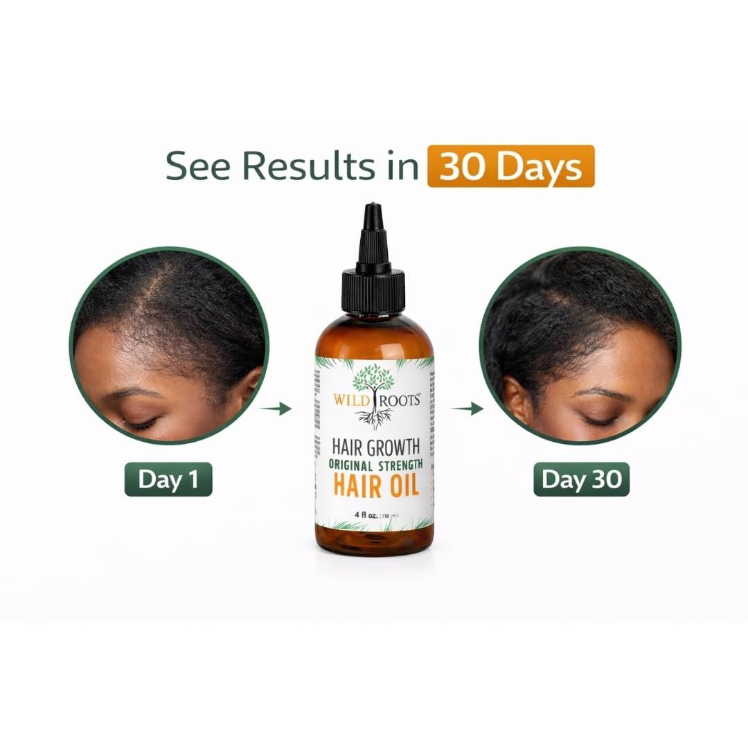 WILD ROOTS Original Strength Hair Growth Oil – Nourishing Formula to Strengthen & Promote Hair Growth – 4oz (118ml) - görsel 9