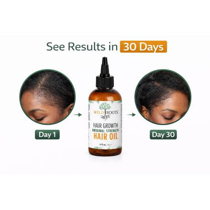 WILD ROOTS Original Strength Hair Growth Oil – Nourishing Formula to Strengthen & Promote Hair Growth – 4oz (118ml)