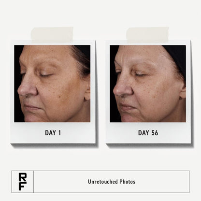 Rodan + Fields Reverse Deep Exfoliating Facial Cleanser with Glycolic Acid & AHAs - Daily AHA Exfoliating Face Wash for Pore Refining & Smoother Skin Texture, 125 mL Avelisse