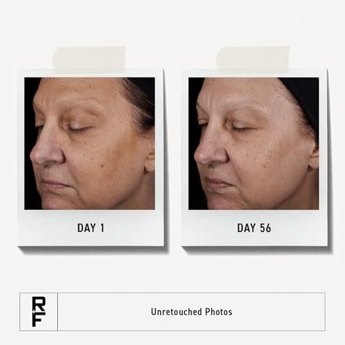 Rodan + Fields Reverse Deep Exfoliating Facial Cleanser with Glycolic Acid & AHAs - Daily AHA Exfoliating Face Wash for Pore Refining & Smoother Skin Texture, 125 mL Avelisse