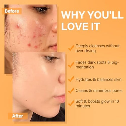 Vitamin C Turmeric Face Mask & Dead Sea Mud Mask Set with Salicylic Acid - Pore Cleansing, Brightening, Blackheads & Dark Spots - 3 Pack, 2.82 oz Each Avelisse