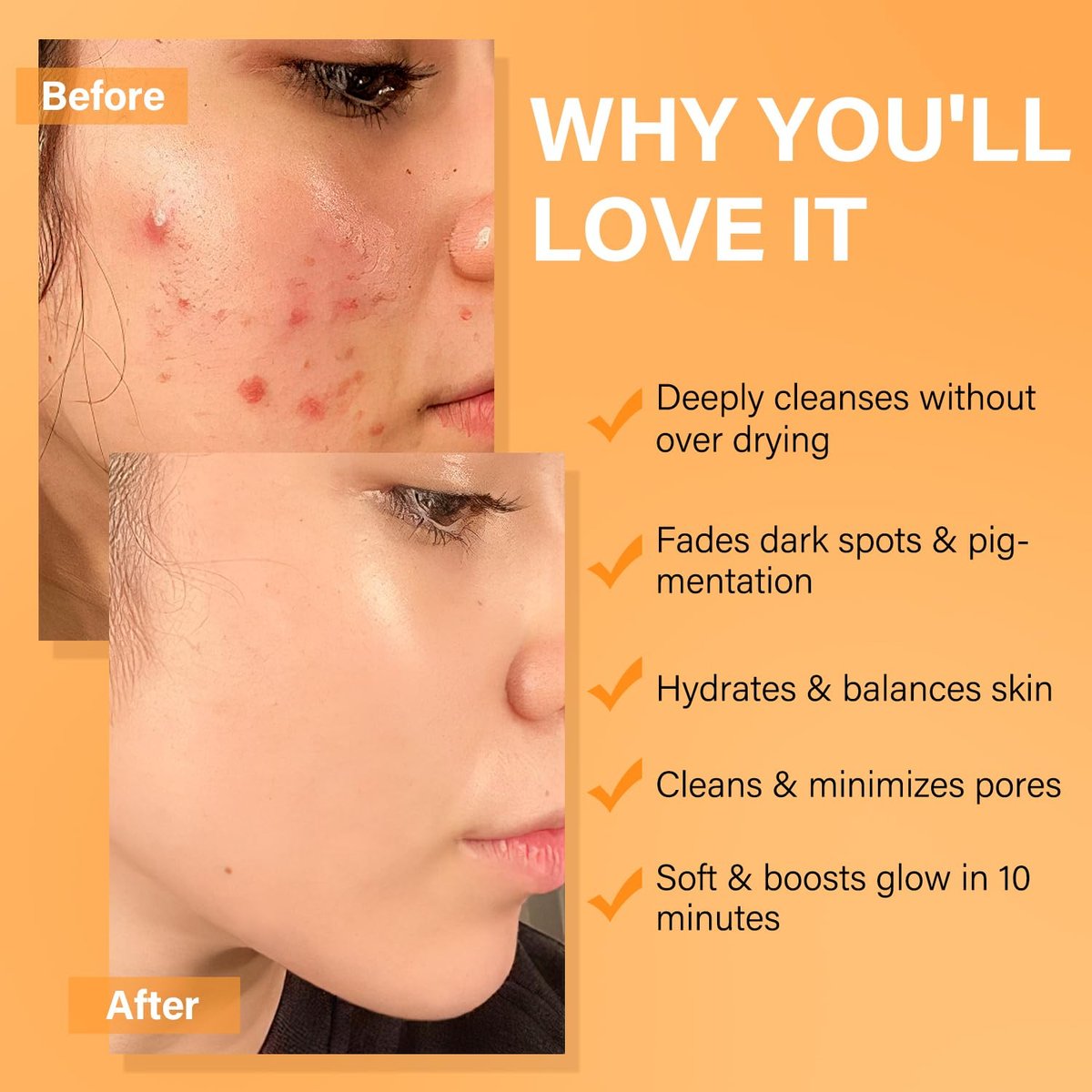 Vitamin C Turmeric Face Mask & Dead Sea Mud Mask Set with Salicylic Acid - Pore Cleansing, Brightening, Blackheads & Dark Spots - 3 Pack, 2.82 oz Each Avelisse