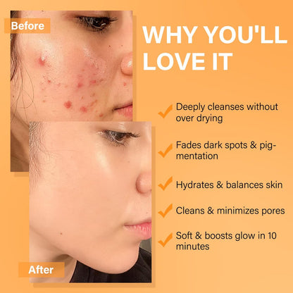 Vitamin C Turmeric Face Mask & Dead Sea Mud Mask Set with Salicylic Acid - Pore Cleansing, Brightening, Blackheads & Dark Spots - 3 Pack, 2.82 oz Each Avelisse