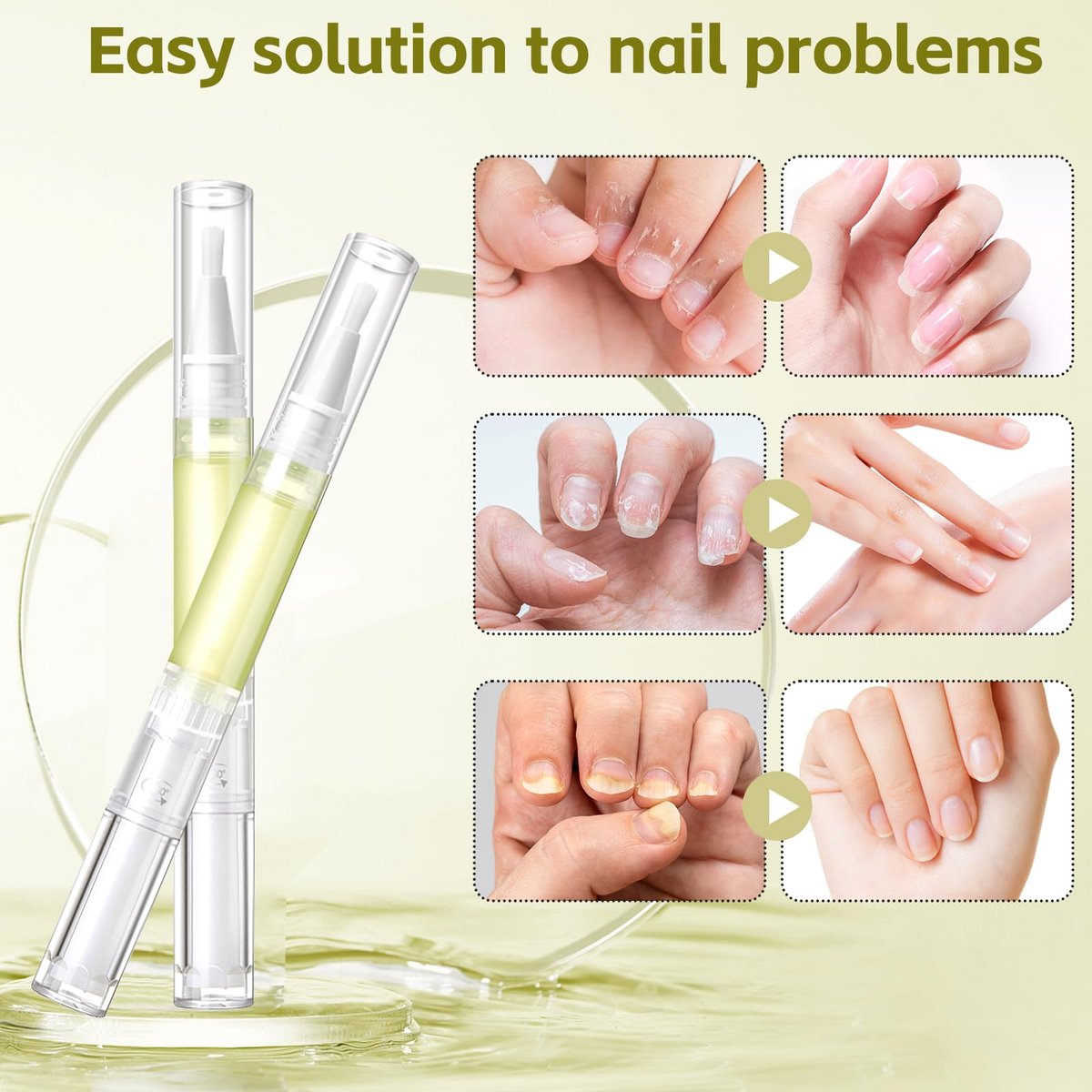 Nailz Nail Growth Pen Set - Radiant Nail Growth Oil, Cuticle Oil for Nails, Nail Strengthener, Moisturizing & Nourishing Pen for Finger Edge Manicure (4-Pack) Avelisse