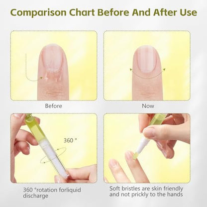 Nailz Nail Growth Pen Set - Radiant Nail Growth Oil, Cuticle Oil for Nails, Nail Strengthener, Moisturizing & Nourishing Pen for Finger Edge Manicure (4-Pack) Avelisse
