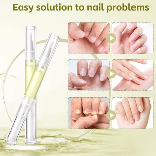 Nailz Nail Growth Pen Set - Radiant Nail Growth Oil, Cuticle Oil for Nails, Nail Strengthener, Moisturizing & Nourishing Pen for Finger Edge Manicure (4-Pack) Avelisse