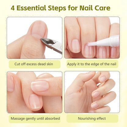 Nailz Nail Growth Pen Set - Radiant Nail Growth Oil, Cuticle Oil for Nails, Nail Strengthener, Moisturizing & Nourishing Pen for Finger Edge Manicure (4-Pack) Avelisse