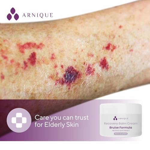 Arnique Arnica Bruise Cream Balm with Vitamin K – Intensive Moisturizing Formula for Seniors with Thin, Mature, Elderly Skin on Legs, Arms, Hands (4 oz) Avelisse