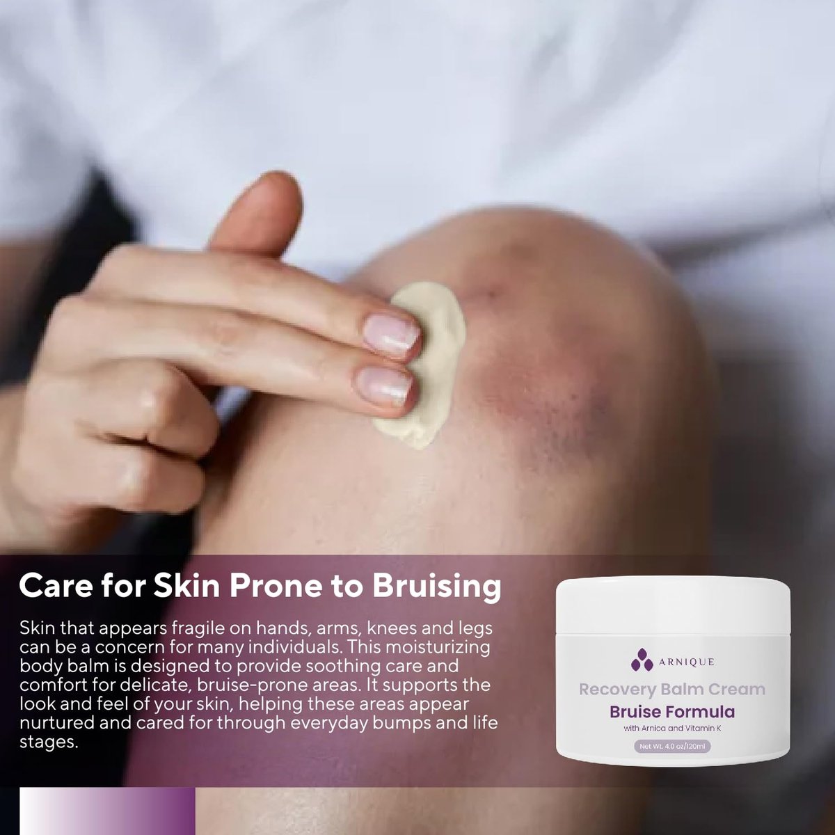 Arnique Arnica Bruise Cream Balm with Vitamin K – Intensive Moisturizing Formula for Seniors with Thin, Mature, Elderly Skin on Legs, Arms, Hands (4 oz) Avelisse