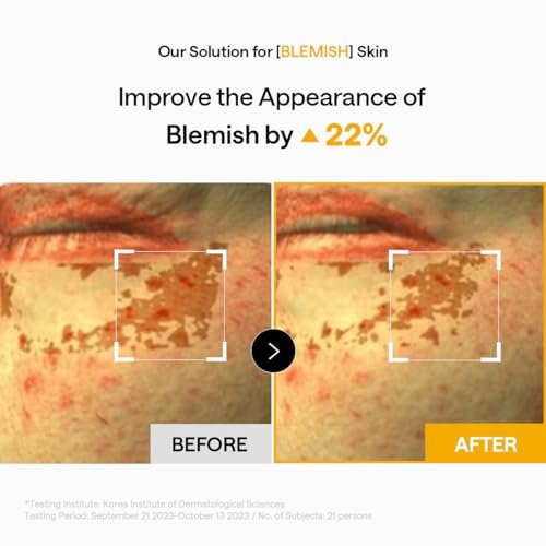 Mediheal Vita Collagen Under Eye Patches - Korean Hydrogel Eye Pads (60 Patches) with 7 Vitamins & 5 Micro Collagen, Moisturizing & Non-Irritating Eye Gel Mask, Sealing Cap Included - görsel 10
