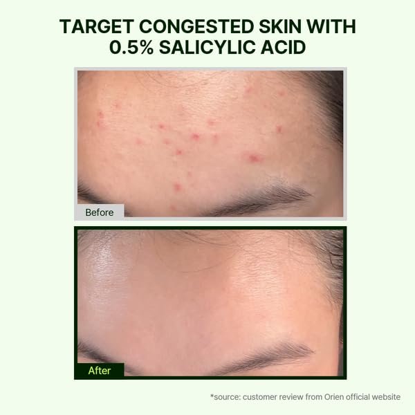 Orien Mugwort Zero Film Cleansing Foam - Daily Makeup Remover & Blackhead Removal, Non-Clogging Pores, Korean Skincare Double Cleansing, 5.07 fl oz (150ml) - görsel 4