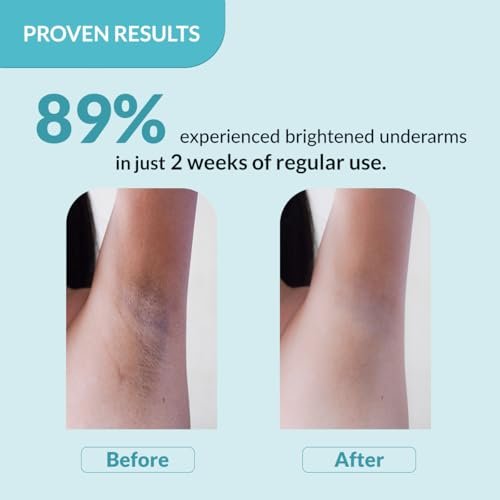 Fixderma Nigrifix Underarm Roll-On with 6% AHA, Lactic Acid & 1% Mandelic Acid & Kojic Acid | Brightens Skin & Exfoliates Underarm | AHA Deodorant for All Skin Types, Men & Women - 60ml Avelisse