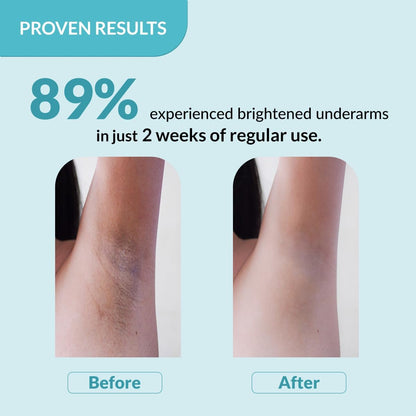 Fixderma Nigrifix Underarm Roll-On with 6% AHA, Lactic Acid & 1% Mandelic Acid & Kojic Acid | Brightens Skin & Exfoliates Underarm | AHA Deodorant for All Skin Types, Men & Women - 60ml Avelisse