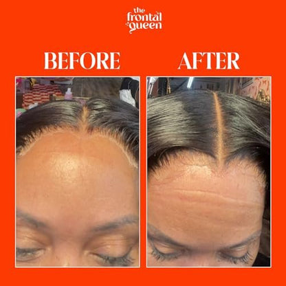 The Frontal Queen Lace Melting Spray - Ashy Lace Melting Spray for Lace Wigs, Extra Hold Lace Bond Spray Adhesive, No Residue, Long Lasting Safe Formula - 4.2 oz Avelisse