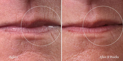 City Lips Line Therapy – Lip Line Fortifying Treatment for Smoothing Vertical Wrinkles & Lipstick Lines | Anti-Aging Cruelty-Free Lip Care Avelisse