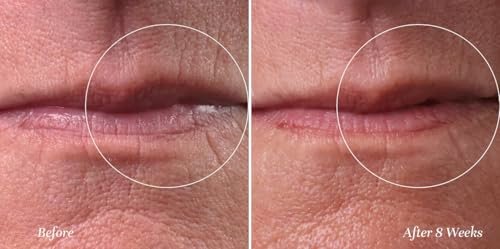 City Lips Line Therapy – Lip Line Fortifying Treatment for Smoothing Vertical Wrinkles & Lipstick Lines | Anti-Aging Cruelty-Free Lip Care Avelisse