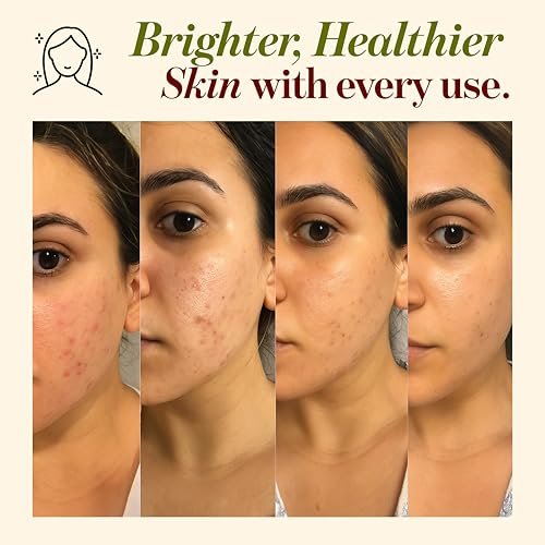 100% Pure Multani Mitti Powder – Indian Healing Clay for Skin Tightening, Deep Pore Cleansing, Tan Removal – 8 oz - görsel 8