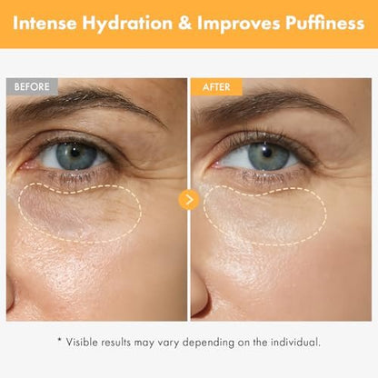 TOSOWOONG VITA Clinic Vitamin Eye Cream – Korean Skincare with 5% Arbutin, 2% Niacinamide, Hyaluronic Acid & Glutathione for Fine Lines, Wrinkles & Puffiness (15ml / 0.5 fl. oz.) Avelisse