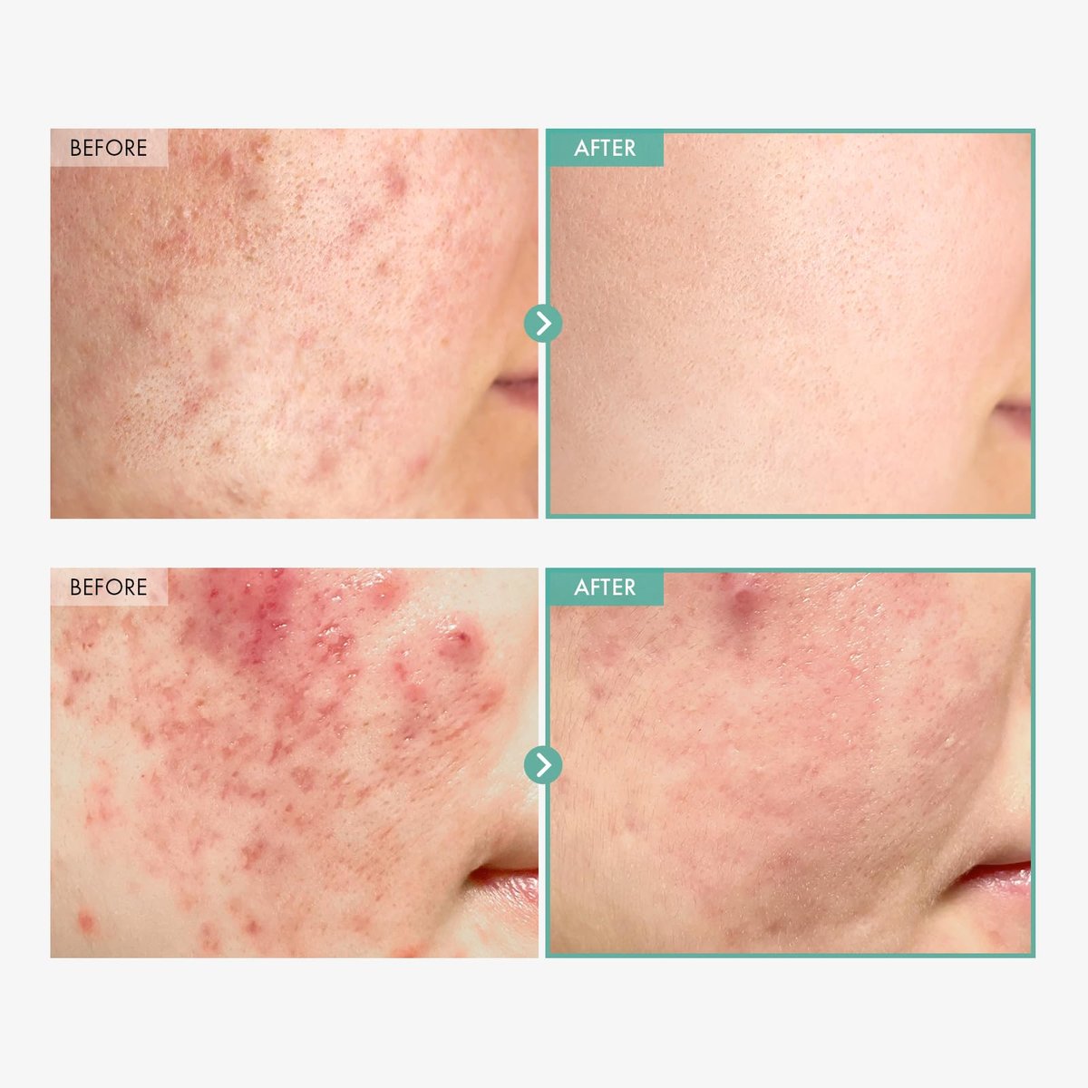 TOSOWOONG Dexpanthenol Cream 170,000ppm B5 Panthenol – Korean Facial Moisturizer for Skin Barrier Repair, Soothing & Hydrating, 60ml - görsel 5