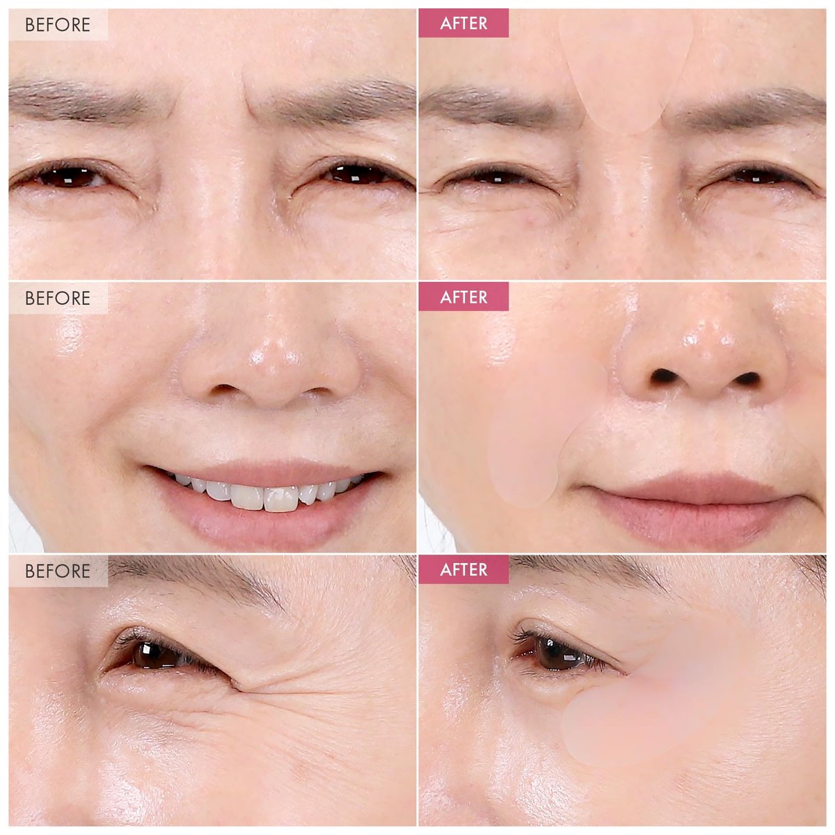 TOSOWOONG Anti-Wrinkle Patch with Hydrolyzed – Overnight Wear: Wear while you sleep for continuous, non-invasive – Image 3