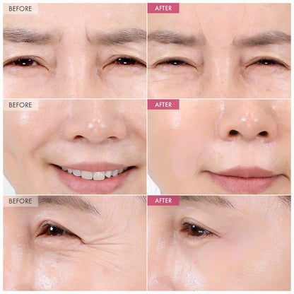 TOSOWOONG Anti-Wrinkle Patch with Hydrolyzed – Overnight Wear: Wear while you sleep for continuous, non-invasive – Image 3