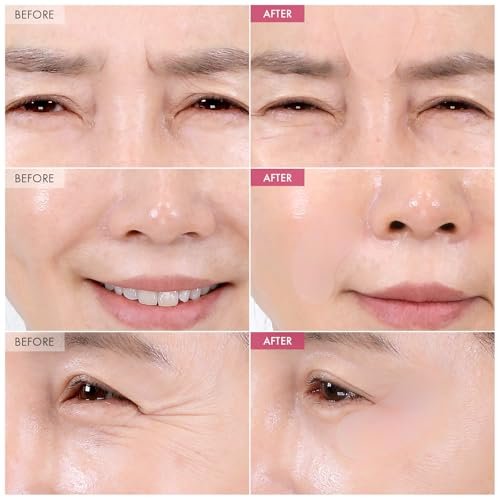 TOSOWOONG Anti-Wrinkle Patch with Hydrolyzed – K-Beauty Innovation: Inspired by Korean skincare rituals, these – Image 4