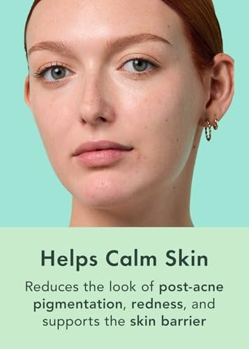 Rael Miracle Clear Serum – Salicylic Acid, Niacinamide & Zinc for Pore Minimizing & Acne-Prone Skin | Korean Skin Care (1 fl oz) Avelisse