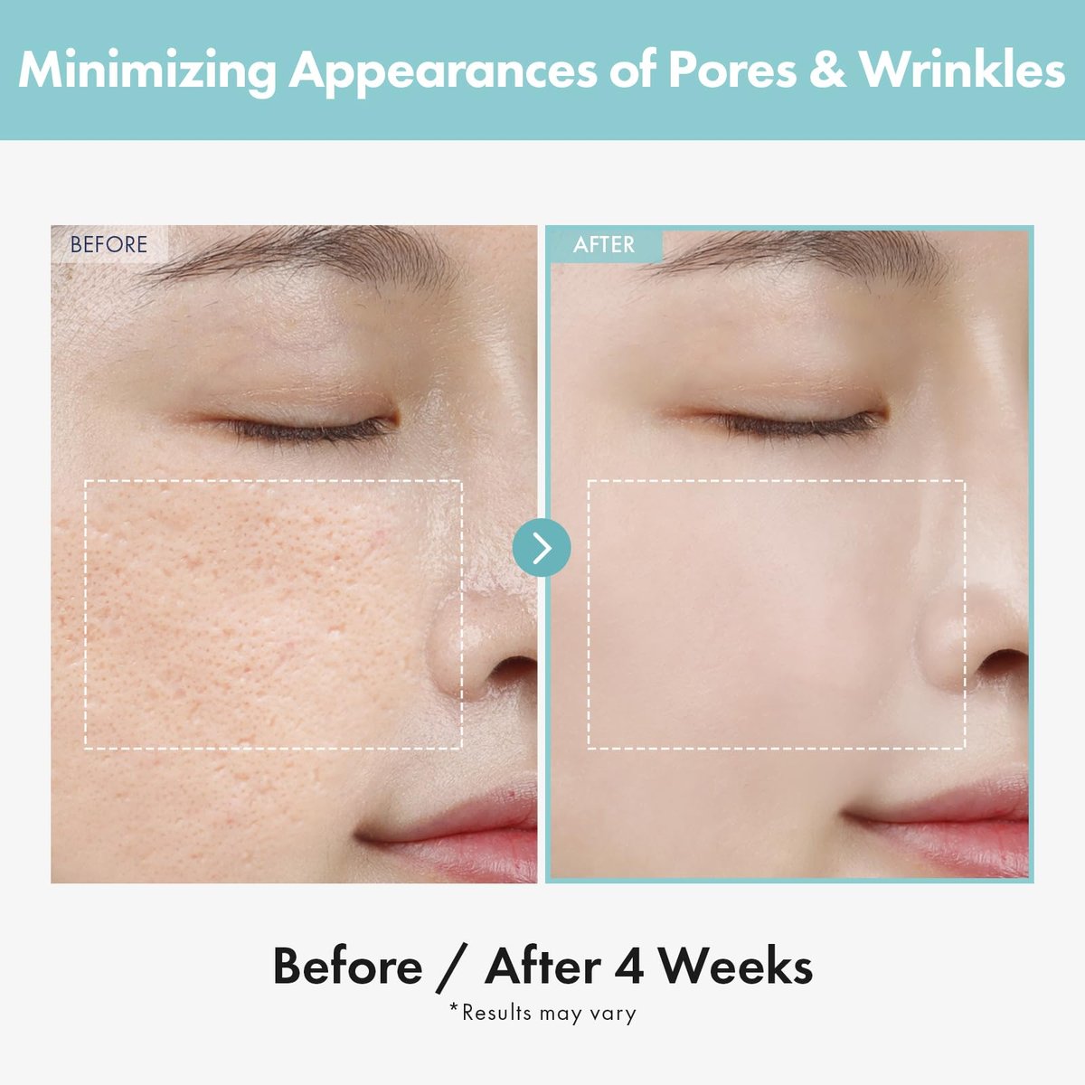 TOSOWOONG Pore Refiner Cream – AHA Pore Minimizer with Glycolic & Lactic Acid, Oil Control Moisturizer for Oily Skin, Texture Smoothing, Korean Skincare, 50g / 1.76 oz - görsel 6